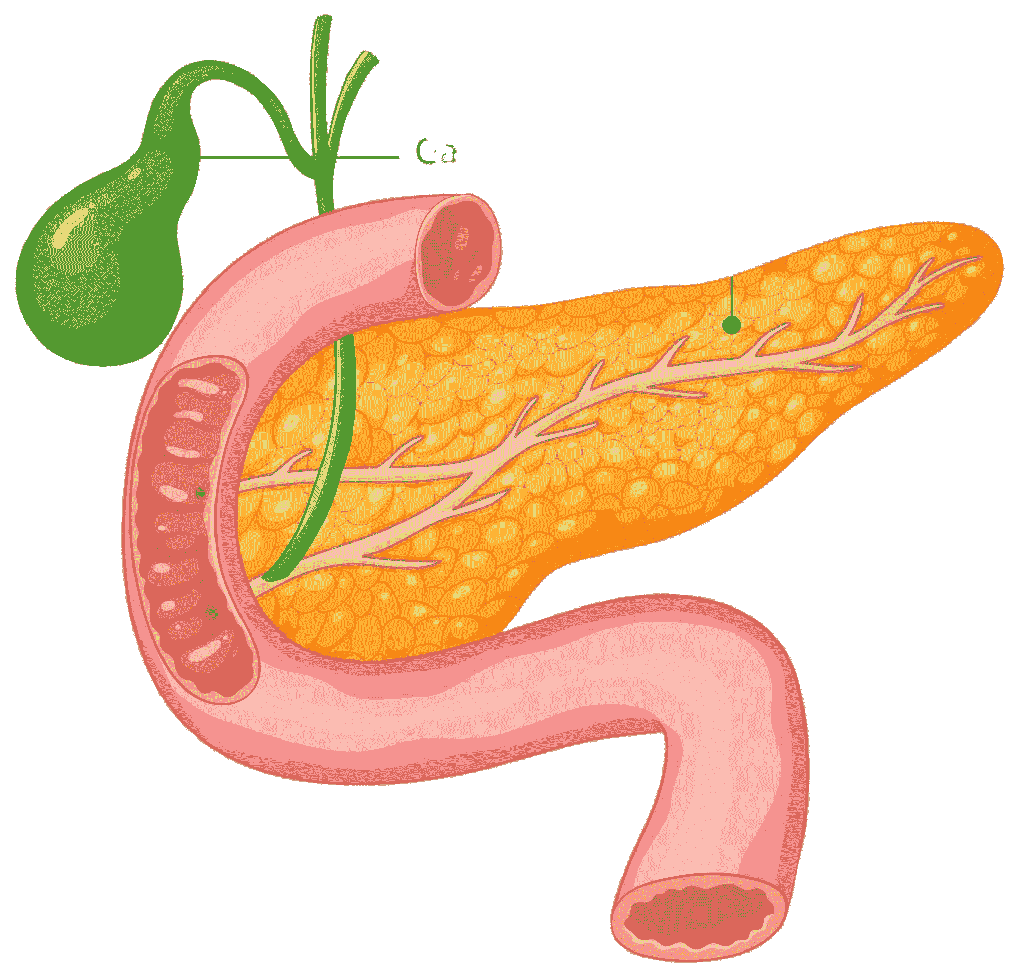 Pancreas Condition